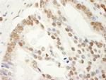 SAM68 Polyclonal Antibody