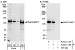 Rab3-GAP1 Polyclonal Antibody