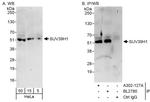 SUV39H1 Polyclonal Antibody