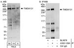 TMEM131 Antibody in Western Blot (WB)
