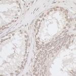 E2F4 Polyclonal Antibody