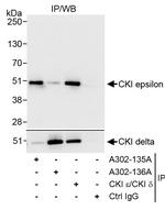 CKI epsilon Antibody in Immunoprecipitation (IP)