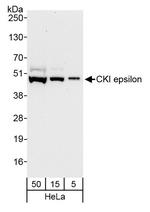 CKI epsilon Polyclonal Antibody