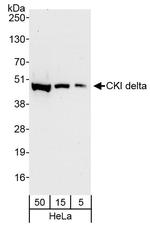 CKI delta Polyclonal Antibody