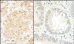 MEK1 Antibody in Immunohistochemistry (Paraffin) (IHC (P))