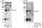AAK1 Antibody in Western Blot (WB)