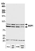 BOP1 Antibody in Western Blot (WB)