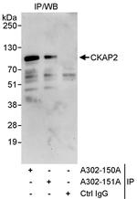 CKAP2 Polyclonal Antibody