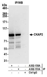 CKAP2 Antibody in Immunoprecipitation (IP)