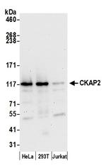 CKAP2 Polyclonal Antibody