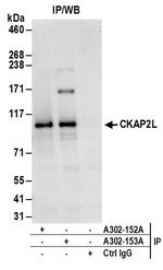 CKAP2L Antibody in Immunoprecipitation (IP)