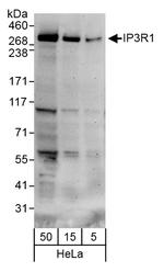 IP3R1 Polyclonal Antibody