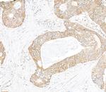 IP3R3 Polyclonal Antibody