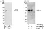 MEKK2 Polyclonal Antibody