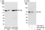 TAB1 Polyclonal Antibody