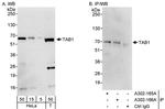 TAB1 Polyclonal Antibody