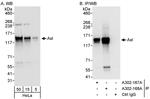 Axl Antibody in Western Blot (WB)