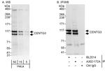 CENTG3 Antibody in Western Blot (WB)