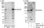 FANCD2 Antibody in Western Blot (WB)