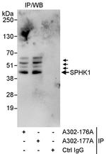 SPHK1 Polyclonal Antibody