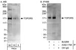 TOPORS Antibody in Western Blot (WB)