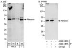 Abraxas Polyclonal Antibody