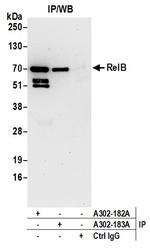 RelB Polyclonal Antibody