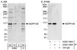NOPP140 Polyclonal Antibody