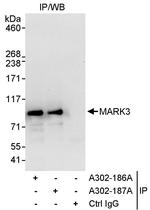MARK3 Polyclonal Antibody