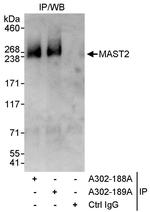 MAST2 Polyclonal Antibody