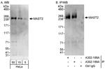 MAST2 Polyclonal Antibody