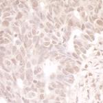 MASTL Polyclonal Antibody