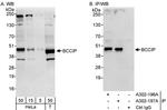 BCCIP Polyclonal Antibody