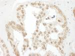 BCCIP Polyclonal Antibody