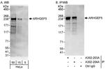 ARHGEF5 Polyclonal Antibody