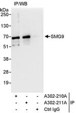 SMG9 Antibody in Immunoprecipitation (IP)