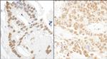 DDX27 Antibody in Immunohistochemistry (Paraffin) (IHC (P))