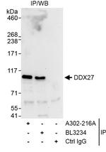 DDX27 Antibody in Immunoprecipitation (IP)