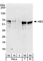 HBO Polyclonal Antibody