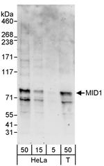 MID1 Polyclonal Antibody