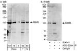 RBM5 Polyclonal Antibody