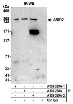 ARID2 Antibody in Immunoprecipitation (IP)