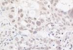 ARID2 Antibody in Immunohistochemistry (Paraffin) (IHC (P))