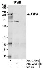 ARID2 Antibody in Immunoprecipitation (IP)