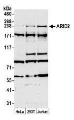 ARID2 Antibody in Western Blot (WB)