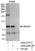 ABLIM1 Polyclonal Antibody