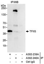 TFIIS Antibody in Immunoprecipitation (IP)