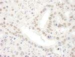 TFIIS Polyclonal Antibody