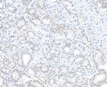 BAP1 Antibody in Immunohistochemistry (Paraffin) (IHC (P))