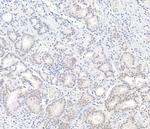 BAP1 Polyclonal Antibody